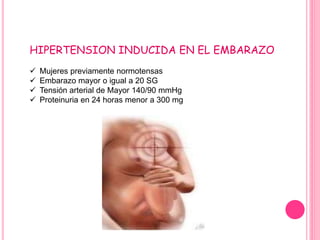 HIPERTENSION INDUCIDA EN EL EMBARAZO
 Mujeres previamente normotensas
 Embarazo mayor o igual a 20 SG
 Tensión arterial de Mayor 140/90 mmHg
 Proteinuria en 24 horas menor a 300 mg
 