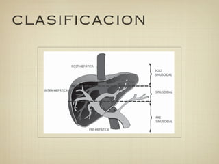 Óxido nítrico               ++    secuencias importantes tanto pronóstica
   Activador plaquetario   +         terapéuticas. A semejanza de lo que oc
                                     la hipertensión arterial, la definición de

CLASIFICACION
   Agentes AMPc
   intracelulares              +++   basa en la medición cuantitativa de la
   Lipo PGE1                   ++
                                     Como se ha señalado, valores sobre 5 m
                                     se consideran diagnósticas. Sin emba




                                                             Figura 2. Clasificaci
                                                             hipertensión portal s
                                                             gar donde ocurre el au
                                                             las resistencias.

  276                                    Gastroenterol. latinoam 2009; Vol 20, Nº 4:
 
