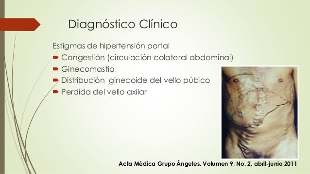 ¿Pérdida del vello púbico y axilar? Descúbrelo aquí” Perdida de vello pubico y axilar