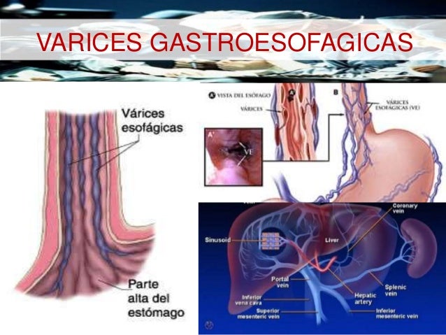 Niños y presión arterial sistólica