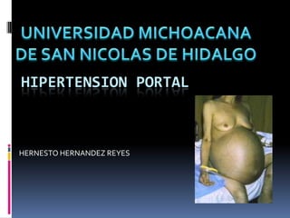 HIPERTENSION PORTAL



HERNESTO HERNANDEZ REYES
 