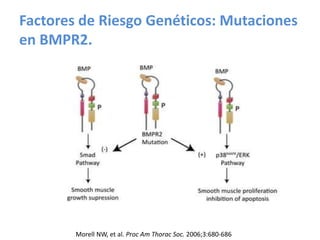 Factores de Riesgo Genéticos: Mutaciones
en BMPR2.
Morell NW, et al. Proc Am Thorac Soc. 2006;3:680-686
 