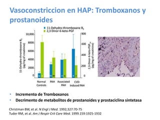 Vasoconstriccion en HAP: Tromboxanos y
prostanoides
• Incremento de Tromboxanos
• Decrimento de metabolitos de prostanoides y prostaciclina sintetasa
Christman BW, et al. N Engl J Med. 1992;327:70-75
Tuder RM, et al. Am J Respir Crit Care Med. 1999.159:1925-1932
 