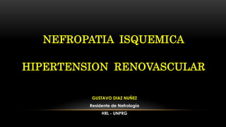 NEFROPATIA ISQUEMICA
HIPERTENSION RENOVASCULAR
GUSTAVO DIAZ NUÑEZ
Residente de Nefrología
HRL - UNPRG
 