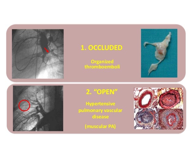 Hipertensiunea Pulmonară Postembolică