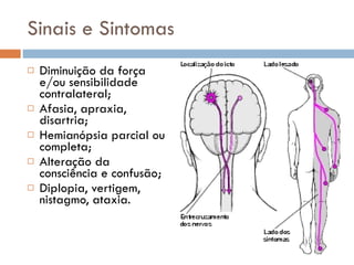Sinais e Sintomas Diminuição da força e/ou sensibilidade contralateral; Afasia, apraxia, disartria; Hemianópsia parcial ou completa; Alteração da consciência e confusão; Diplopia, vertigem, nistagmo, ataxia. 