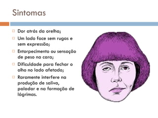 Sintomas Dor atrás da orelha; Um lado face sem rugas e sem expressão; Entorpecimento ou sensação de peso na cara; Dificuldade para fechar o olho no lado afetado; Raramente interfere na produção de saliva, paladar e na formação de lágrimas. 