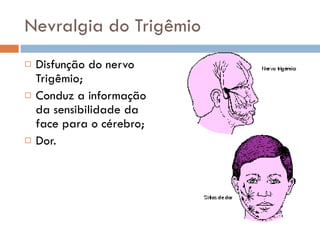 Nevralgia do Trigêmio Disfunção do nervo Trigêmio; Conduz a informação da sensibilidade da face para o cérebro; Dor. 