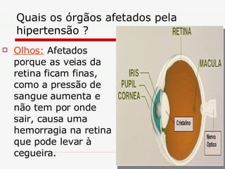 Quais os órgãos afetados pela hipertensão ? Olhos:  Afetados  porque as veias da retina ficam finas, como a pressão de sangue aumenta e não tem por onde sair, causa uma hemorragia na retina que pode levar à cegueira. 