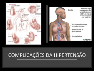 COMPLICAÇÕES DA HIPERTENSÃO
 