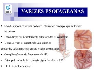 VARIZES ESOFAGEANAS
 São dilatações das veias do terço inferior do esôfago, que se tornam
tortuosas.
 Estão direta ou indiretamente relacionadas às colaterais.
 Desenvolvem-se a partir da veia gástrica
esquerda, veias gástricas curtas e veias esofagianas
 Complicações mais frequentes da HP.
 Principal causa de hemorragia digestiva alta na HP.
 EDA  melhor exame!
 