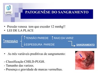 PATOGENÊSE DO SANGRAMENTO
• Pressão venosa tem que exceder 12 mmhg!!
• LEI DE LA PLACE
• As três variáveis preditivas de sangramento:
- Classificação CHILD-PUGH.
- Tamanho das varizes.
- Presença e gravidade de marcas vermelhas.
TENSÃO PAREDE RAIO DA VARIZ
PRESSÃO
ESPESSURA PAREDE SANGRAMENTO
 