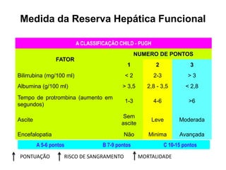 A CLASSIFICAÇÃO CHILD - PUGH
FATOR
NUMERO DE PONTOS
1 2 3
Bilirrubina (mg/100 ml) < 2 2-3 > 3
Albumina (g/100 ml) > 3,5 2,8 - 3,5 < 2,8
Tempo de protrombina (aumento em
segundos)
1-3 4-6 >6
Ascite
Sem
ascite
Leve Moderada
Encefalopatia Não Minima Avançada
A 5-6 pontos B 7-9 pontos C 10-15 pontos
Medida da Reserva Hepática Funcional
PONTUAÇÃO RISCO DE SANGRAMENTO MORTALIDADE
 