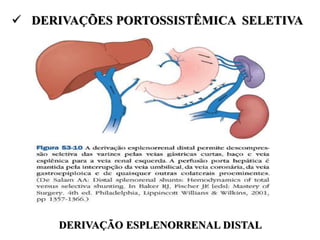  DERIVAÇÕES PORTOSSISTÊMICA SELETIVA
DERIVAÇÃO ESPLENORRENAL DISTAL
 