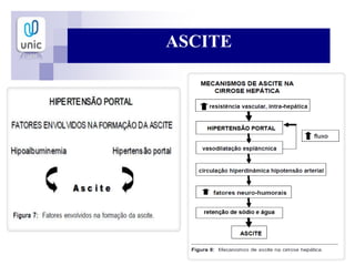 ASCITE
 
