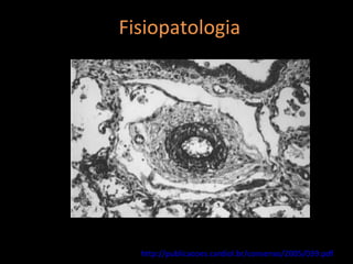 Fisiopatologia




  http://publicacoes.cardiol.br/consenso/2005/039.pdf
 