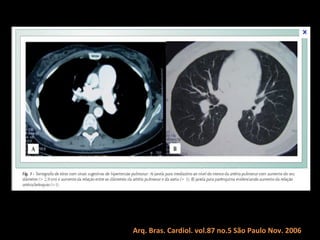 Arq. Bras. Cardiol. vol.87 no.5 São Paulo Nov. 2006
 