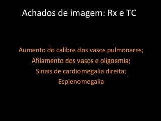 Achados de imagem: Rx e TC


Aumento do calibre dos vasos pulmonares;
   Afilamento dos vasos e oligoemia;
    Sinais de cardiomegalia direita;
            Esplenomegalia
 