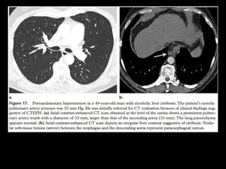 http://radiographics.rsna.org/content/30/7/1753.full.pdf+html
 