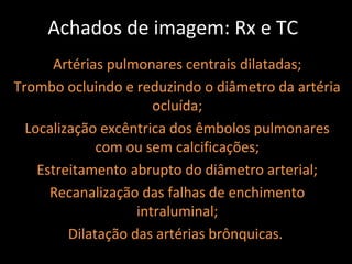 Achados de imagem: Rx e TC
      Artérias pulmonares centrais dilatadas;
Trombo ocluindo e reduzindo o diâmetro da artéria
                       ocluída;
  Localização excêntrica dos êmbolos pulmonares
              com ou sem calcificações;
    Estreitamento abrupto do diâmetro arterial;
      Recanalização das falhas de enchimento
                    intraluminal;
         Dilatação das artérias brônquicas.
 