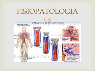 
FISIOPATOLOGIA
 