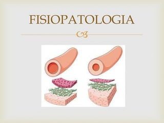 
FISIOPATOLOGIA
 