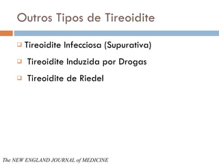 Outros Tipos de Tireoidite Tireoidite Infecciosa (Supurativa) Tireoidite Induzida por Drogas Tireoidite de Riedel The NEW ENGLAND JOURNAL of   MEDICINE 