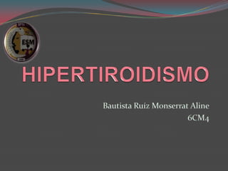 HIPERTIROIDISMO Bautista Ruíz MonserratAline 6CM4 