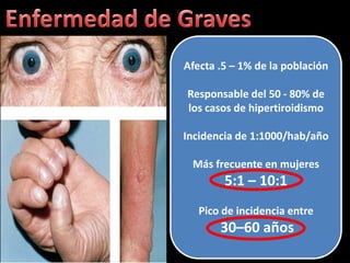 Afecta .5 – 1% de la población

Responsable del 50 - 80% de
los casos de hipertiroidismo

Incidencia de 1:1000/hab/año

 Más frecuente en mujeres
        5:1 – 10:1
   Pico de incidencia entre
       30–60 años
 