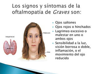 





Ojos saltones
Ojos rojos o hinchados
Lagrimeo excesivo o
malestar en uno o
ambos ojos
Sensibilidad a la luz,
visión borrosa o doble,
inflamación, o el
movimiento del ojo
reducido

 