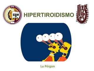 HIPERTIROIDISMO
Lu Pérgon
 