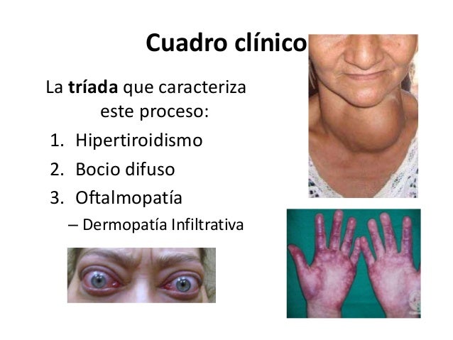 dieta para bajar la grasa corporal rapidamente dieta para bajar la grasa corporal rapidamente