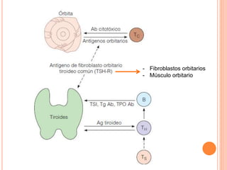 - Fibroblastos orbitarios 
- Músculo orbitario 
 