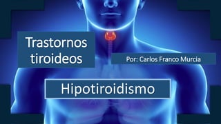 Trastornos
tiroideos
Hipotiroidismo
Por: Carlos Franco Murcia
 