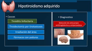 Hipotiroidismo adquirido
• Causas
Tiroiditis linfocitaria
Tiroidectomía por tirotoxicosis
• Diagnostico
Detección de anticuerpos
antitiroglobulina y antiperoxidasa
Irradiación del área
Fármacos con yoduros
 