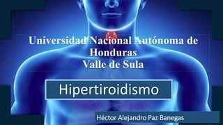 Universidad Nacional Autónoma de
Honduras
Valle de Sula
Hipertiroidismo
Héctor Alejandro Paz Banegas
 