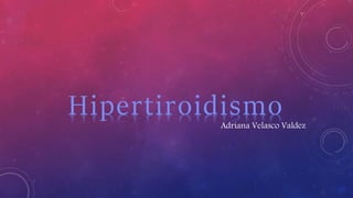 Adriana Velasco Valdez
Hipertiroidismo
 