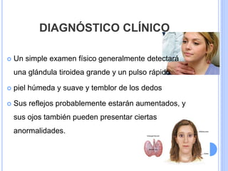 DIAGNÓSTICO CLÍNICO
 Un simple examen físico generalmente detectará
una glándula tiroidea grande y un pulso rápido
 piel húmeda y suave y temblor de los dedos
 Sus reflejos probablemente estarán aumentados, y
sus ojos también pueden presentar ciertas
anormalidades.
 