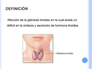 DEFINICIÓN
Afección de la glándula tiroides en la cual existe un
déficit en la síntesis y secreción de hormona tiroidea
 