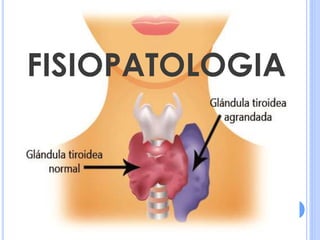 FISIOPATOLOGIA
 