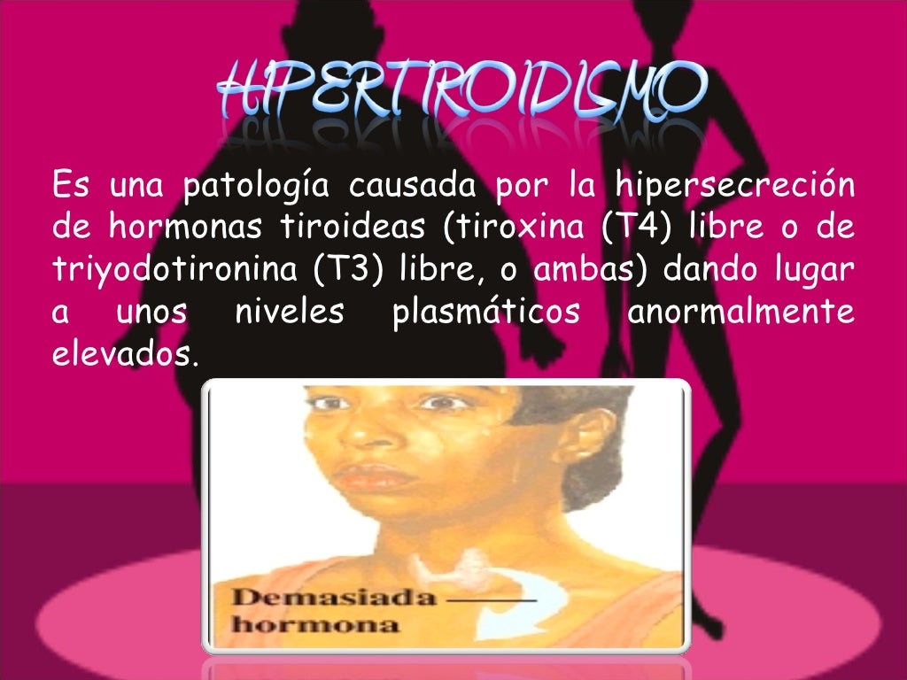 Hipertiroidismo E Hipotiroidismo