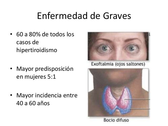 Las causas y el tratamiento de la fuerte caída de los cabello a las mujeres el tratamiento