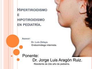 Hipertiroidismo e hipotiroidismo en pediatría. Asesor: 	Dr. Luis Zelaya. Endocrinólogo internista. Ponente: Dr. Jorge Luis Aragón Ruiz. Residente de 2do año de pediatría. 