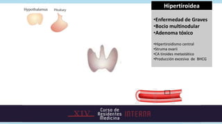 NO Hipertiroidea

•Tiroiditis
•Iatrogénica:
ingestión hormona

•Tiroiditis actínica
•Hamburger tirotoxicosis
 