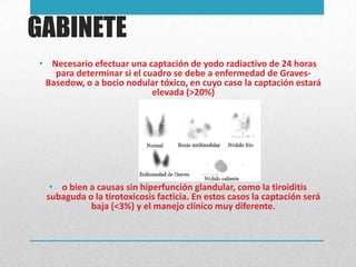 GABINETE
• Necesario efectuar una captación de yodo radiactivo de 24 horas
para determinar si el cuadro se debe a enfermedad de GravesBasedow, o a bocio nodular tóxico, en cuyo caso la captación estará
elevada (>20%)

• o bien a causas sin hiperfunción glandular, como la tiroiditis
subaguda o la tirotoxicosis facticia. En estos casos la captación será
baja (<3%) y el manejo clínico muy diferente.

 