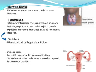 HIPERTIROIDISMO
Síndrome secundario a exceso de hormonas
tiroideas.
TIROTOXICOSIS
Estado caracterizado por un exceso de hormona
tiroidea, se produce cuando los tejidos quedan
expuestos en concentraciones altas de hormonas
tiroideas.
Se debe a:
-Hiperactividad de la glándula tiroides.

Otras causas:
-Ingestión excesiva de hormona tiroidea
-Secreción excesiva de hormona tiroidea a partir
de un tumor ovárico.

 