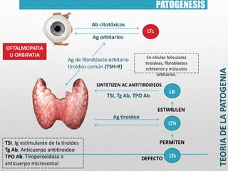PATOGENESIS
Ab citotóxicos
LTc
OFTALMOPATIA
U ORBIPATIA

Ag de fibroblasto orbitario
tiroideo común (TSH-R)

En células foliculares
tiroideas, fibroblastos
orbitarios y músculos
orbitarios.

SINTETIZEN AC ANTITIROIDEOS

LB

TSI, Tg Ab, TPO Ab

ESTIMULEN
Ag tiroideo

LTh
TSI. Ig estimulante de la tiroides
Tg Ab. Anticuerpo antitiroideo
TPO Ab. Tiroperoxidasa o
anticuerpo microsomal

PERMITEN

DEFECTO

LTs

TEORIA DE LA PATOGENIA

Ag orbitarios

 