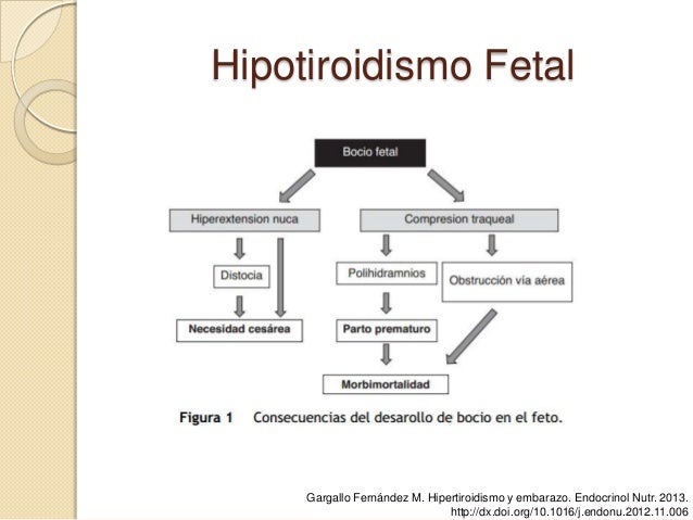 Hipertiroidismo Y Embarazo