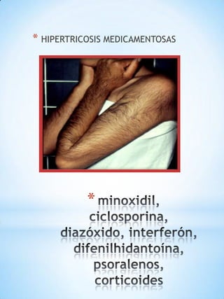 * HIPERTRICOSIS MEDICAMENTOSAS

*

 