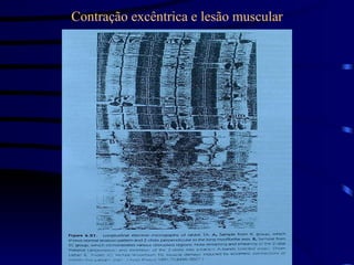 Contração excêntrica e lesão muscular 